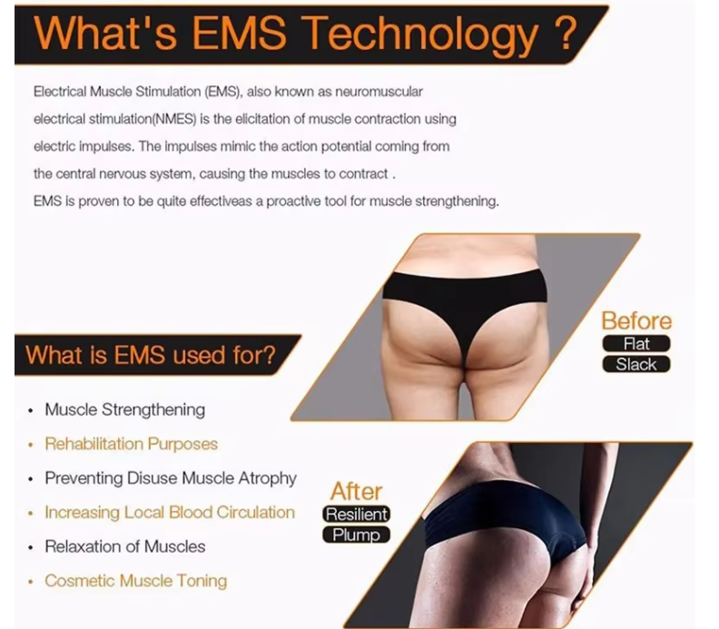 culpt Your Curves: The Ultimate EMS Buttocks Stimulator for Effortless Confidence.