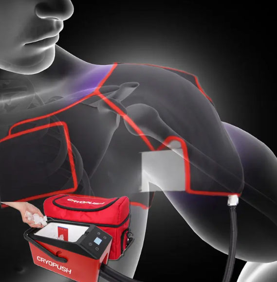 Revitalize Your Healing: The Ultimate Pulse Cold Compression Therapy System for Fast Recovery from Shoulder Surgery, Inflammation, and Pain