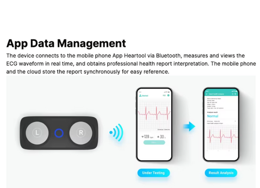 HeartGuard 600: The Smart Portable ECG Monitor for Ultimate Heart Health Protection