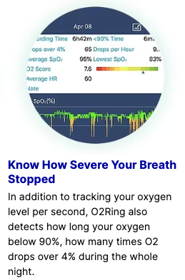 Breathe Easy: The Smart O2Ring for Real-Time Health Insights